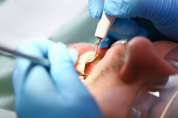 Best Emergency Dentist for Knocked-Out Tooth in Lockport, IL
