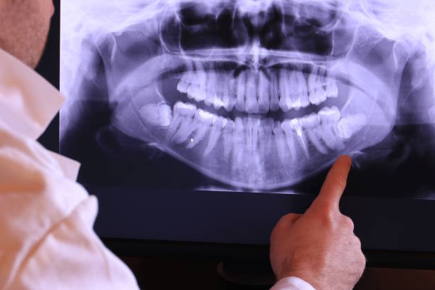 Best Emergency Dentist for Lost Fillings or Crowns in Lockport, IL